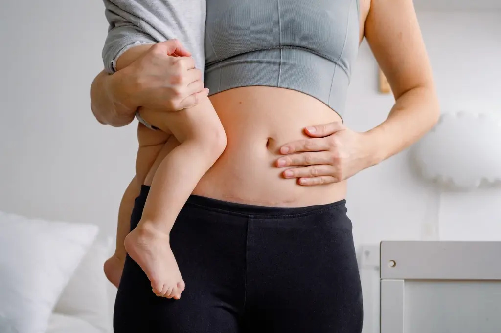 Frau im Sporttop hält Baby an der Hüfte, legt Hand auf ihren Bauch mit sichtbarer Kaiserschnitt‑Narbe.